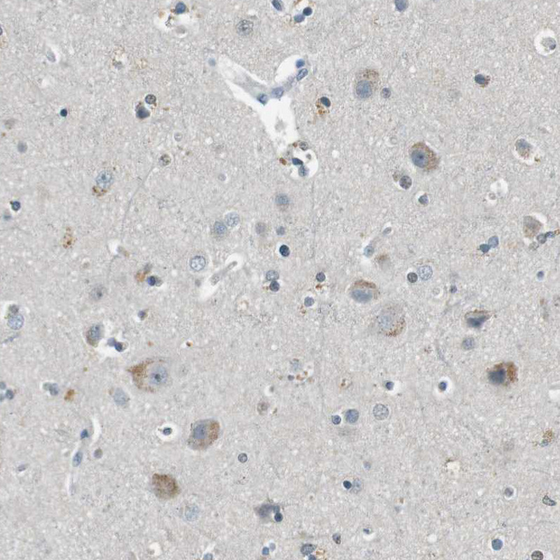 Immunohistochemical staining of human Cerebral cortex shows moderate cytoplasmic positivity in neuronal cells.