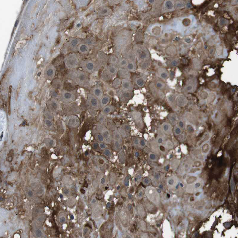 Immunohistochemical staining of human placenta shows strong membranous positivity in decidual cells.