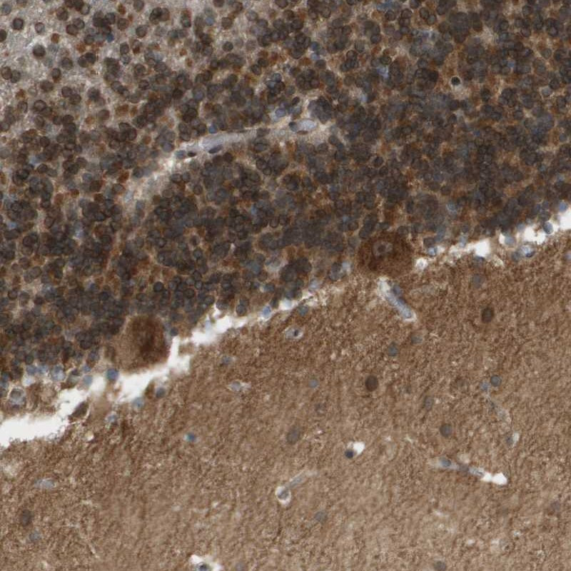 Immunohistochemical staining of human cerebellum shows strong cytoplasmic positivity in most cells.