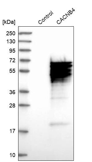 Western blot analysis in control (vector only transfected HEK293T lysate) and CACNB4 over-expression lysate (Co-expressed with a C-terminal myc-DDK tag (~3.1 kDa) in mammalian HEK293T cells, LY400240).
