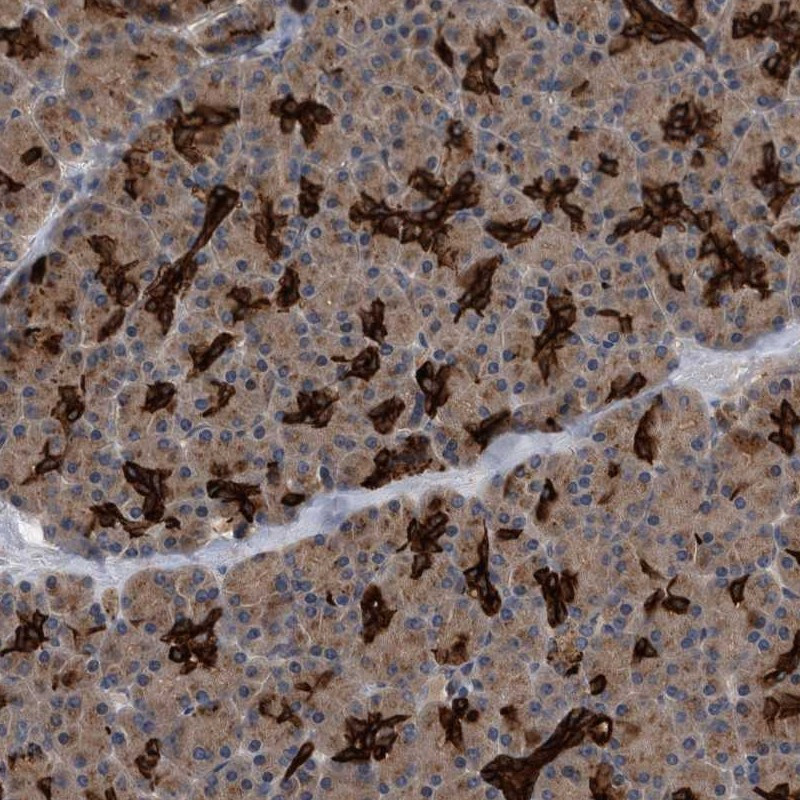 Immunohistochemical staining of human pancreas shows strong positivity in ductal cells.