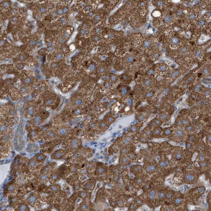 Immunohistochemical staining of human liver shows cytoplasmic positivity in hepatocytes.