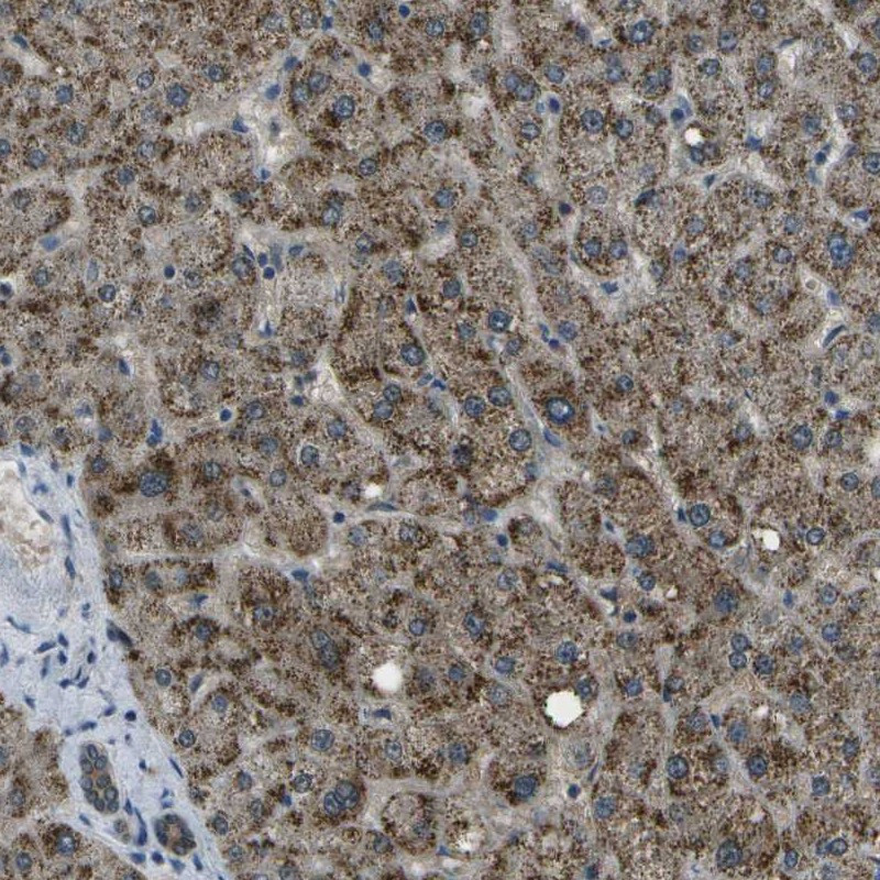 Immunohistochemical staining of human liver shows strong granular positivity in hepatocytes.