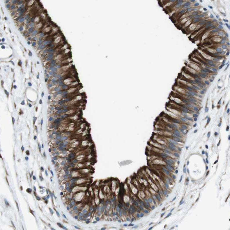 Immunohistochemical staining of human nasopharynx shows strong membranous and cytoplasmic positivity in respiratory epithelial cells.