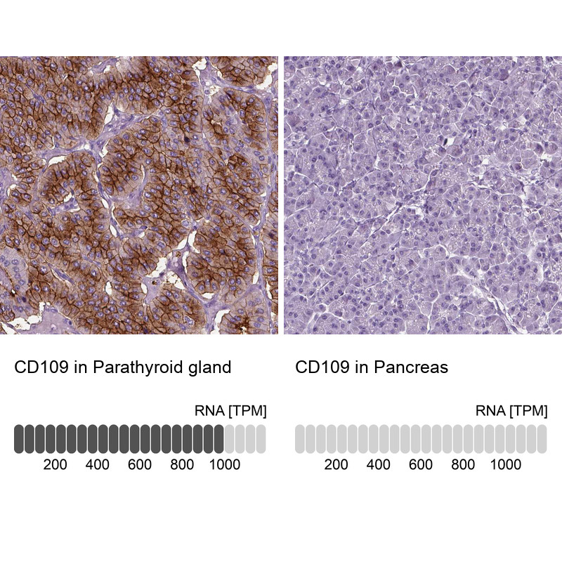 Immunohistochemistry analysis in human parathyroid gland and pancreas tissues using HPA015723 antibody. Corresponding CD109 RNA-seq data are presented for the same tissues.