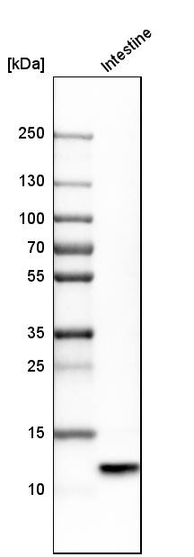 Western blot analysis in human small intestine tissue.