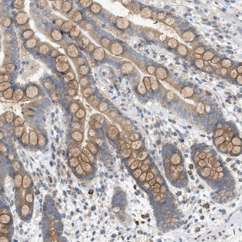 Immunohistochemical staining of human colon shows cytoplasmic positivity in glandular cells.