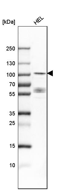 Western blot analysis in human cell line HEL.