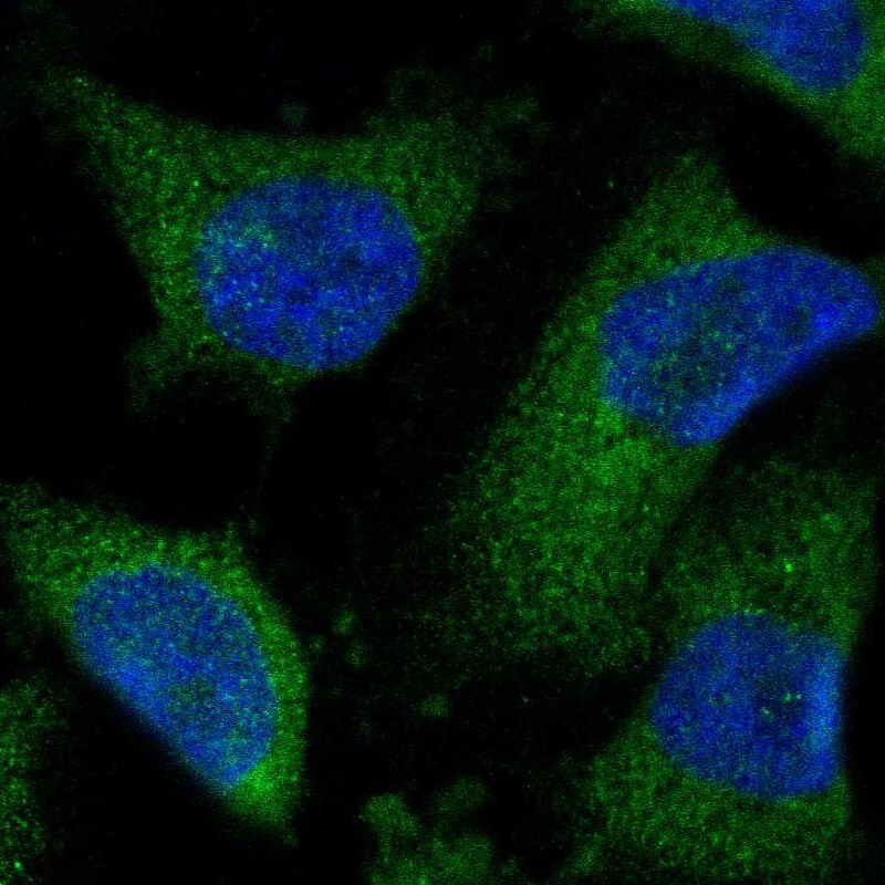 Immunofluorescent staining of human cell line U-251 MG shows localization to endoplasmic reticulum.
