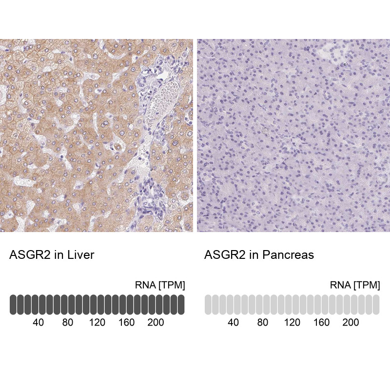 Immunohistochemistry analysis in human liver and pancreas tissues using Anti-ASGR2 antibody. Corresponding ASGR2 RNA-seq data are presented for the same tissues.