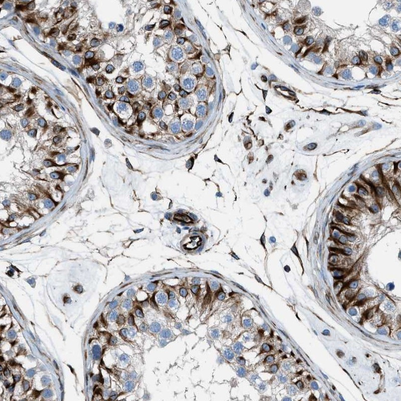 Immunohistochemical staining of human testis shows strong positivity in sertoli cells.