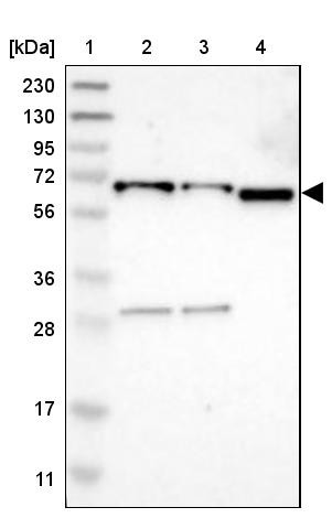 Lane 1: Marker [kDa] 230, 130, 95, 72, 56, 36, 28, 17, 11<br/>Lane 2: Human cell line RT-4<br/>Lane 3: Human cell line U-251MG sp<br/>Lane 4: Human plasma (IgG/HSA depleted)