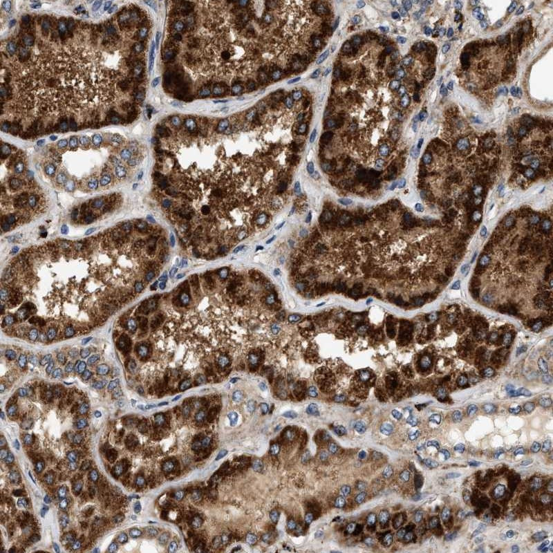 Immunohistochemical staining of human kidney shows strong cytoplasmic positivity with granular pattern in renal tubules.