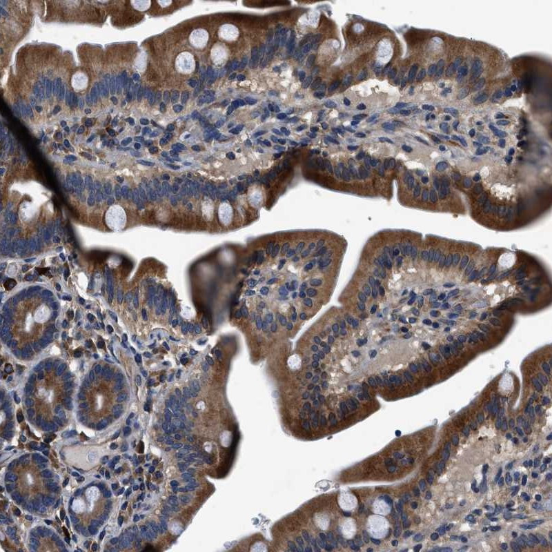 Immunohistochemical staining of human duodenum shows cytoplasmic positivity in glandular cells.