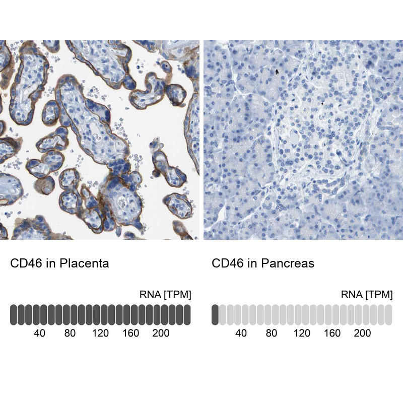 Immunohistochemistry analysis in human placenta and pancreas tissues using HPA016903 antibody. Corresponding CD46 RNA-seq data are presented for the same tissues.