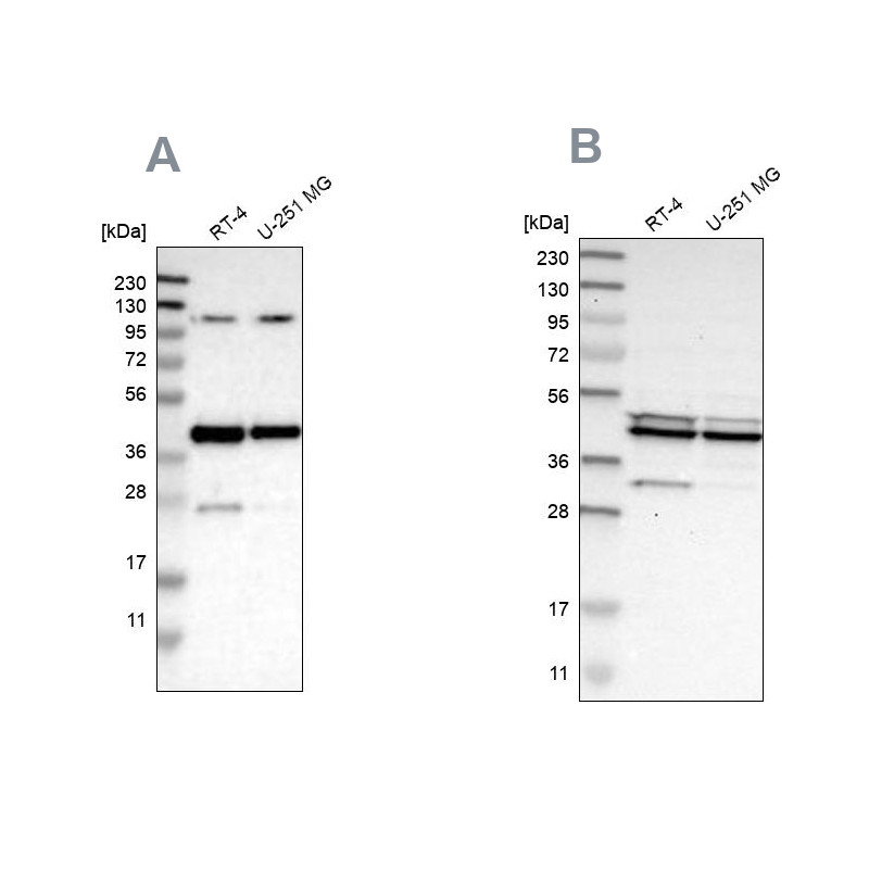 Western blot analysis using Anti-CFAP36 antibody HPA017061 (A) shows similar pattern to independent antibody HPA008994 (B).
