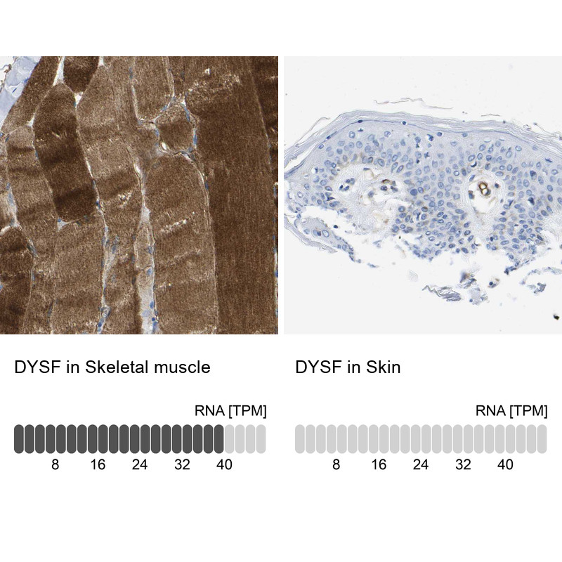 Immunohistochemistry analysis in human skeletal muscle and skin tissues using HPA017071 antibody. Corresponding DYSF RNA-seq data are presented for the same tissues.