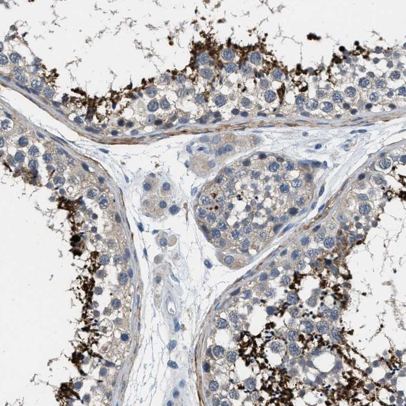Immunohistochemical staining of human testis shows distinct positivity in spermatids and spermatozoa.