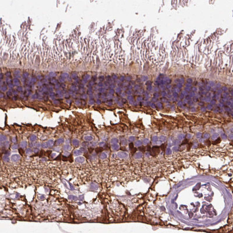 Immunohistochemical staining of human retina shows cytoplasmic positivity in cells in inner nuclear layer and nerve fibers. 