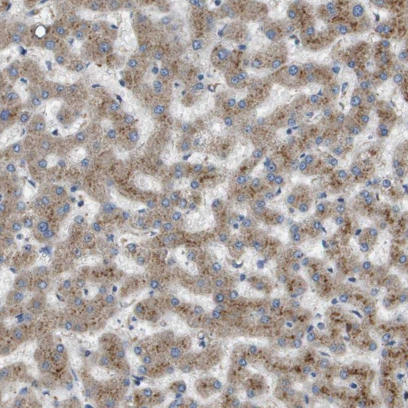 Immunohistochemical staining of human liver shows moderate granular positivity in hepatocytes.