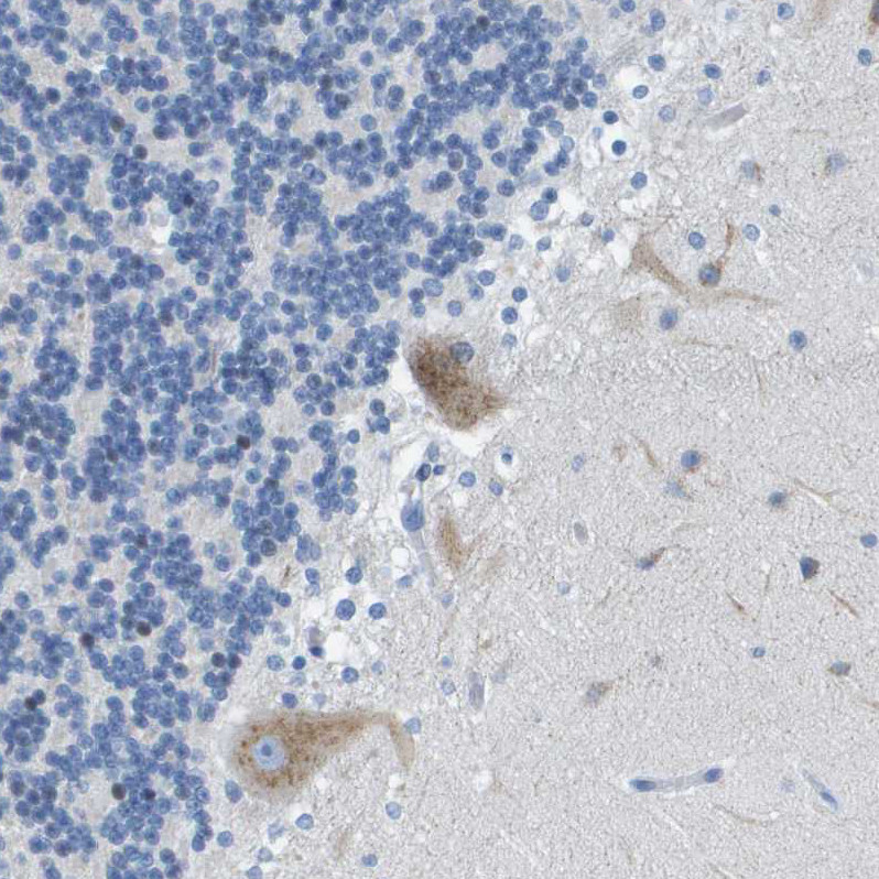 Immunohistochemical staining of human cerebellum shows moderate to strong cytoplasmic positivity in purkinje cells.