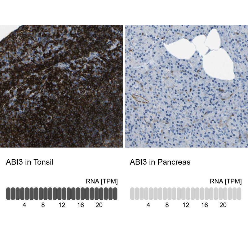 Immunohistochemistry analysis in human tonsil and pancreas tissues using HPA017345 antibody. Corresponding ABI3 RNA-seq data are presented for the same tissues.
