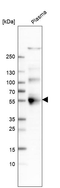 Western blot analysis in human plasma.