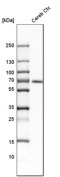 Western blot analysis in human cerebral cortex tissue.
