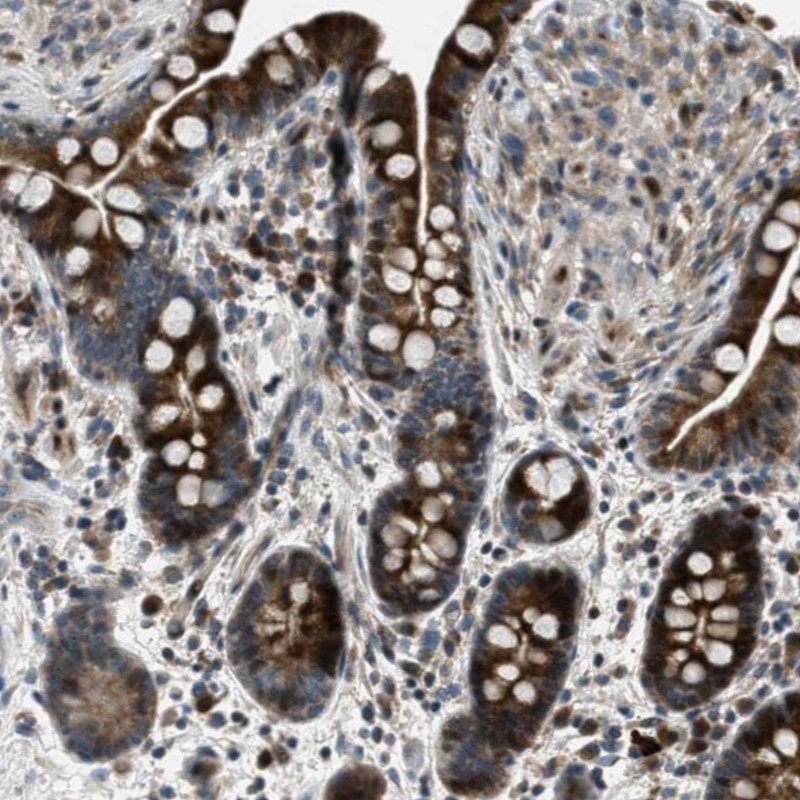 Immunohistochemical staining of human colon shows strong positivity in glandular cells. 