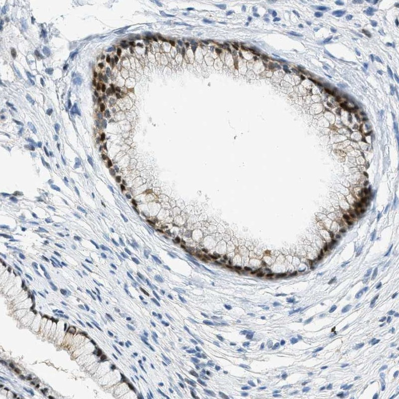 Immunohistochemical staining of human cervix, uterine shows nuclear and cytoplasmic positivity in glandular cells.