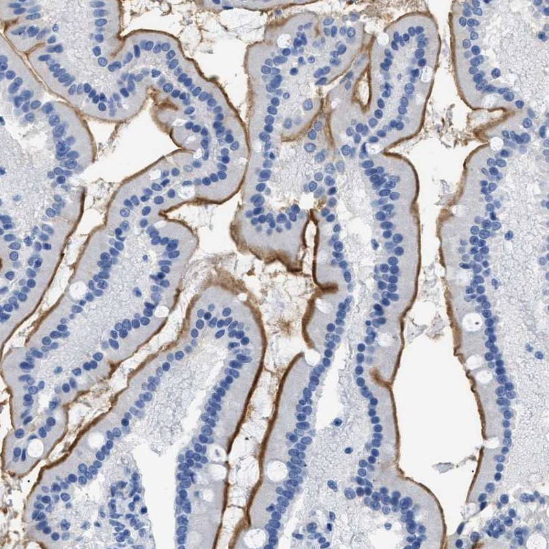 Immunohistochemical staining of human duodenum shows distinct positivity of microvilli in glandular cells.
