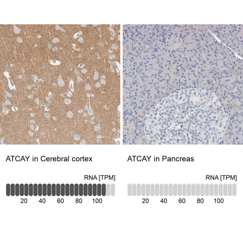 Immunohistochemistry analysis in human cerebral cortex and pancreas tissues using Anti-ATCAY antibody. Corresponding ATCAY RNA-seq data are presented for the same tissues.