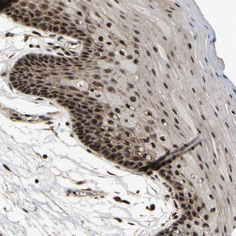 Immunohistochemical staining of human oral mucosa shows nuclear positivity in squamous epithelial cells.
