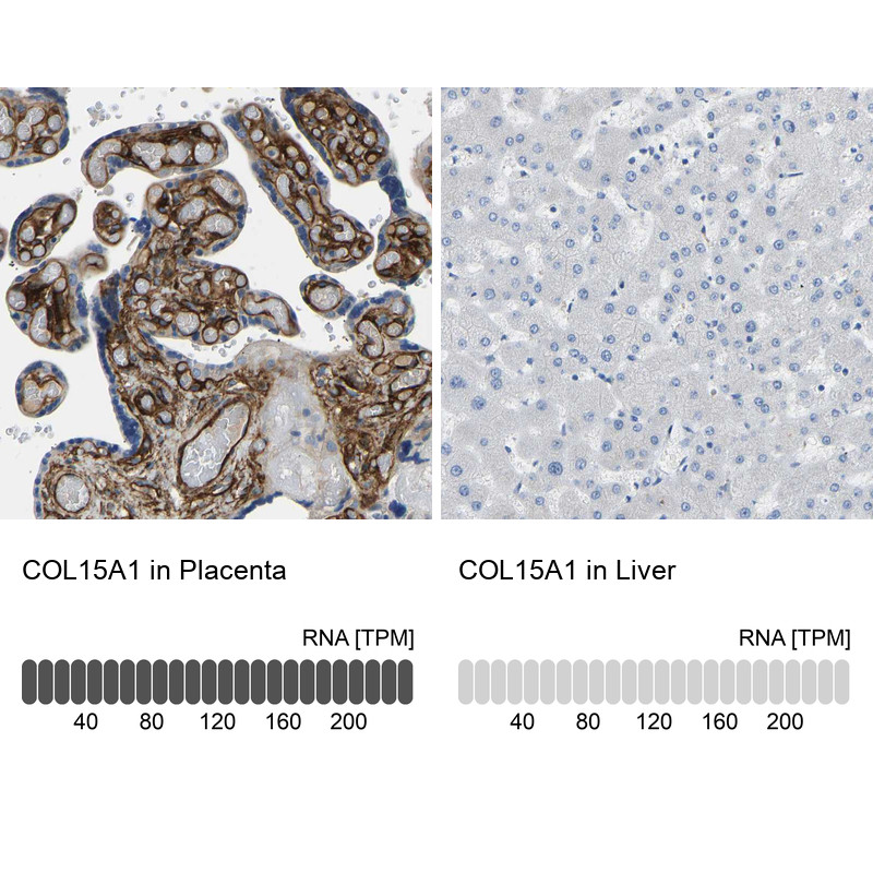 Immunohistochemistry analysis in human placenta and liver tissues using HPA017913 antibody. Corresponding COL15A1 RNA-seq data are presented for the same tissues.