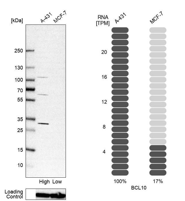 Western blot analysis in human cell line A-431 and human cell line MCF-7.