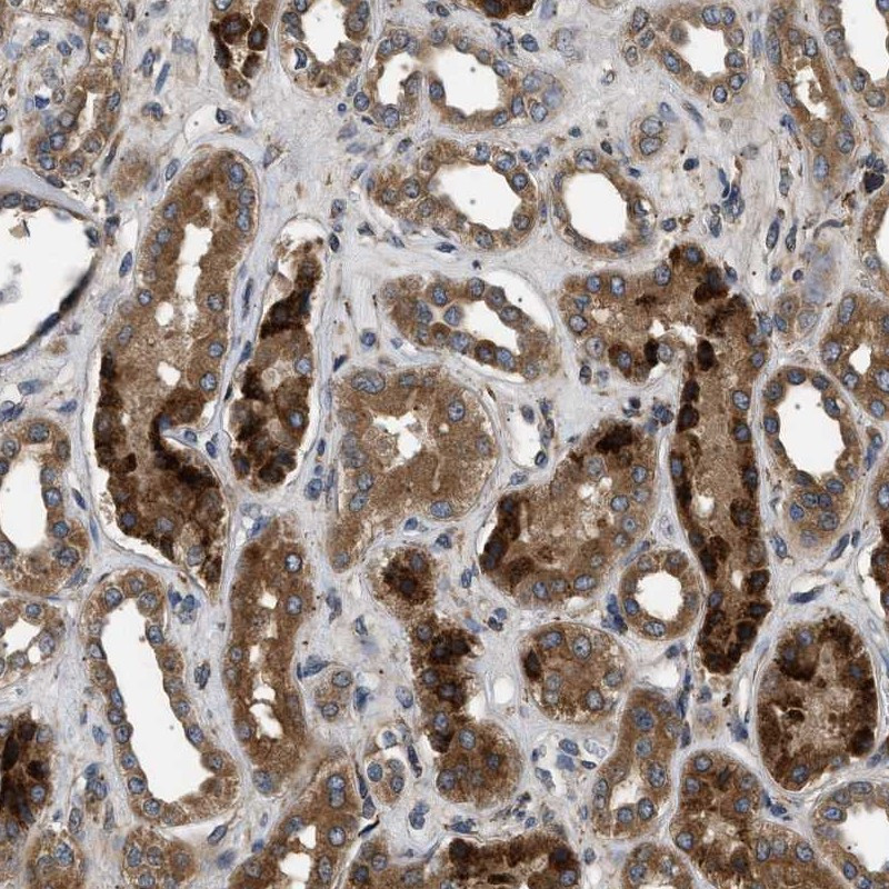 Immunohistochemical staining of human kidney shows strong positivity in tubuli.
