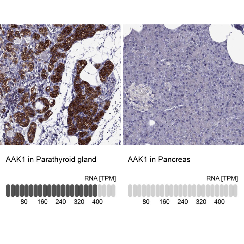 Immunohistochemistry analysis in human parathyroid gland and pancreas tissues using Anti-AAK1 antibody. Corresponding AAK1 RNA-seq data are presented for the same tissues.