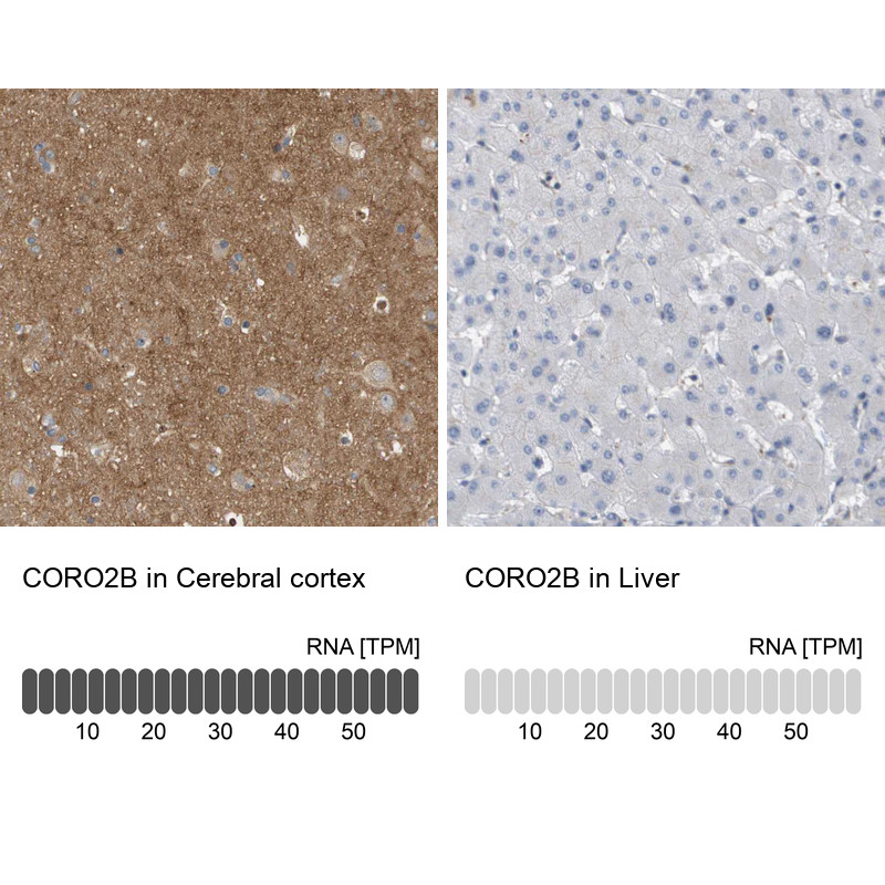 Immunohistochemistry analysis in human cerebral cortex and liver tissues using HPA017960 antibody. Corresponding CORO2B RNA-seq data are presented for the same tissues.
