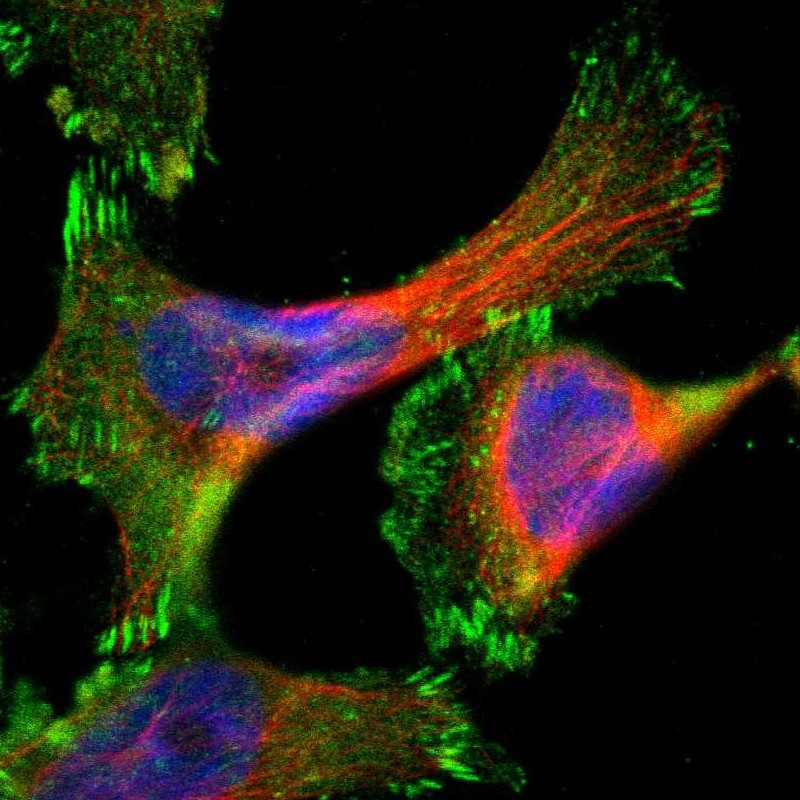 Immunofluorescent staining of human cell line U-251 MG shows localization to plasma membrane & focal adhesion sites.