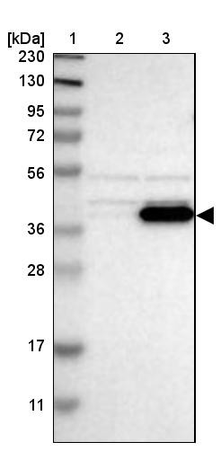 Lane 1: Marker [kDa] 230, 130, 95, 72, 56, 36, 28, 17, 11<br/>Lane 2: Human cell line RT-4<br/>Lane 3: Human cell line U-251MG sp