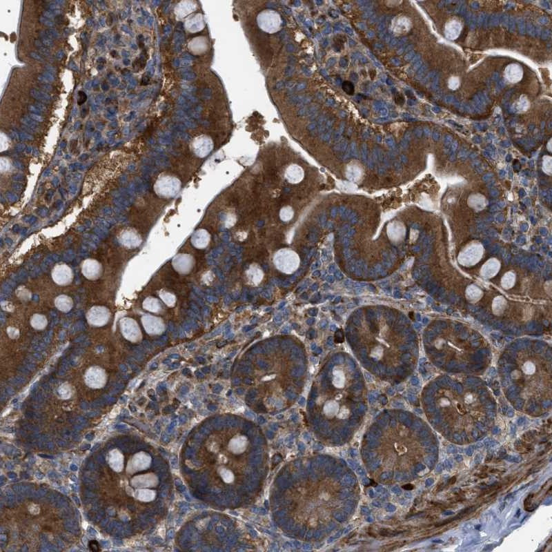 Immunohistochemical staining of human duodenum shows strong cytoplasmic positivity in glandular cells.