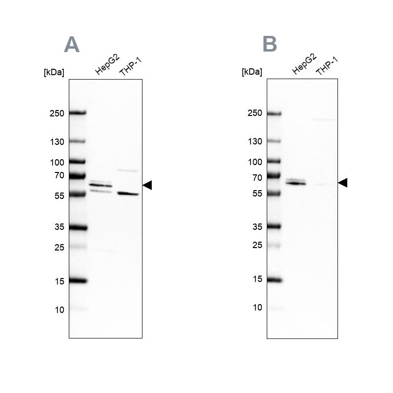 Western blot analysis using Anti-CDR2 antibody HPA018151 (A) shows similar pattern to independent antibody HPA023870 (B).