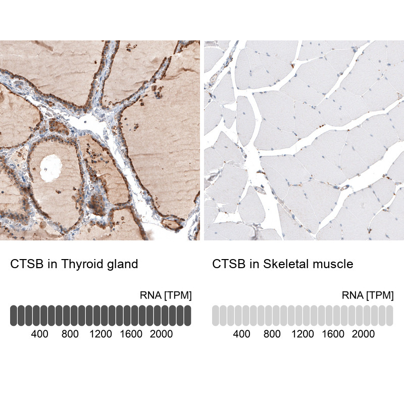 Immunohistochemistry analysis in human thyroid gland and skeletal muscle tissues using HPA018156 antibody. Corresponding CTSB RNA-seq data are presented for the same tissues.