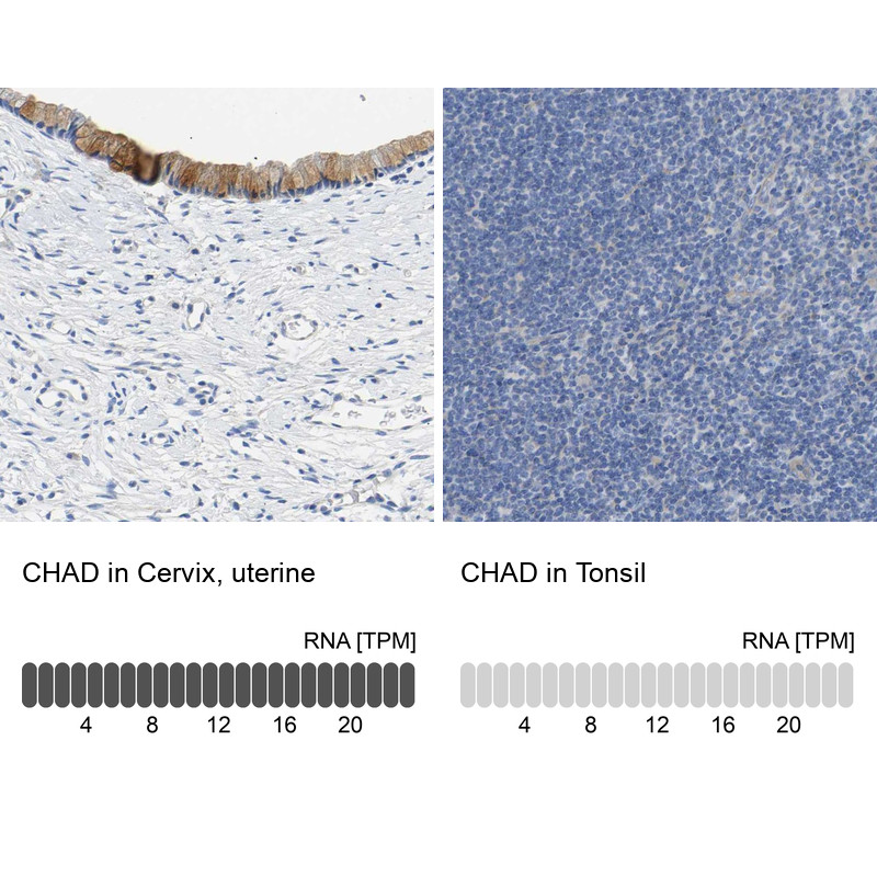Immunohistochemistry analysis in human cervix, uterine and tonsil tissues using Anti-CHAD antibody. Corresponding CHAD RNA-seq data are presented for the same tissues.