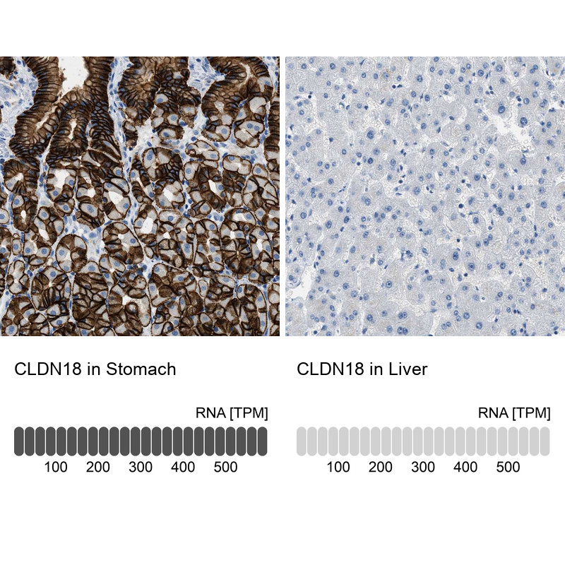 Immunohistochemistry analysis in human stomach and liver tissues using HPA018446 antibody. Corresponding CLDN18 RNA-seq data are presented for the same tissues.