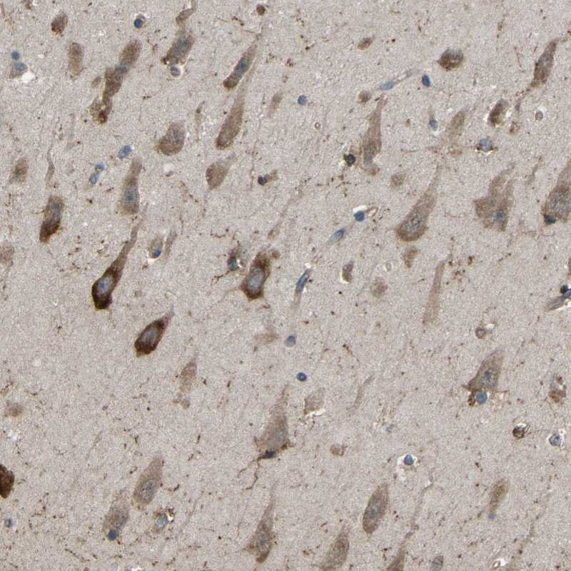 Immunohistochemical staining of human hippocampus shows distinct cytoplasmic positivity in neuronal cells.