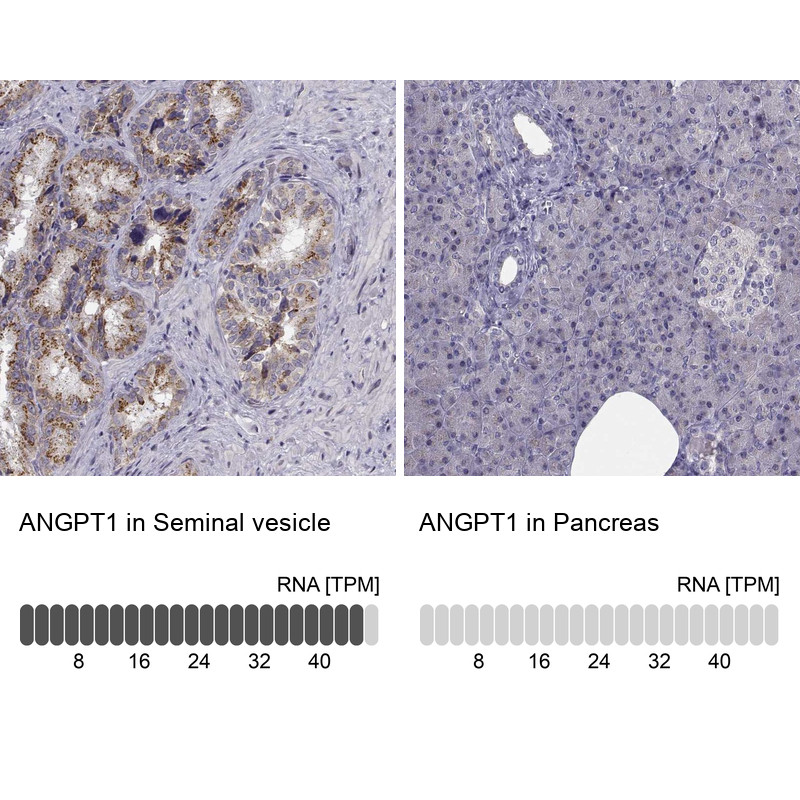 Immunohistochemistry analysis in human seminal vesicle and pancreas tissues using Anti-ANGPT1 antibody. Corresponding ANGPT1 RNA-seq data are presented for the same tissues.