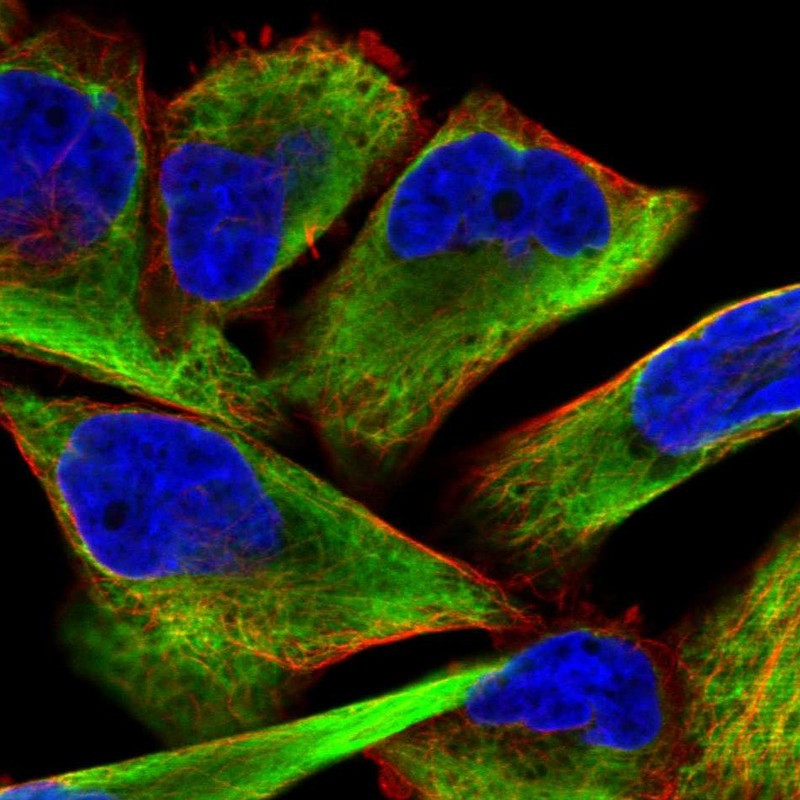 Immunofluorescent staining of human cell line RH-30 shows localization to intermediate filaments.