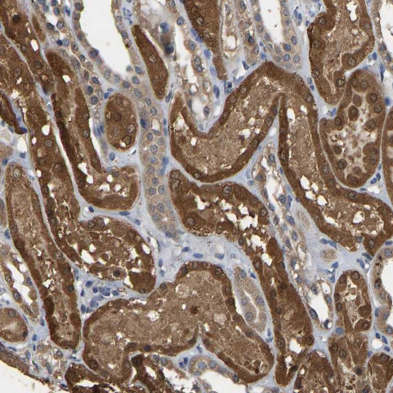 Immunohistochemical staining of human kidney shows moderate cytoplasmic positivity in cells in tubules.