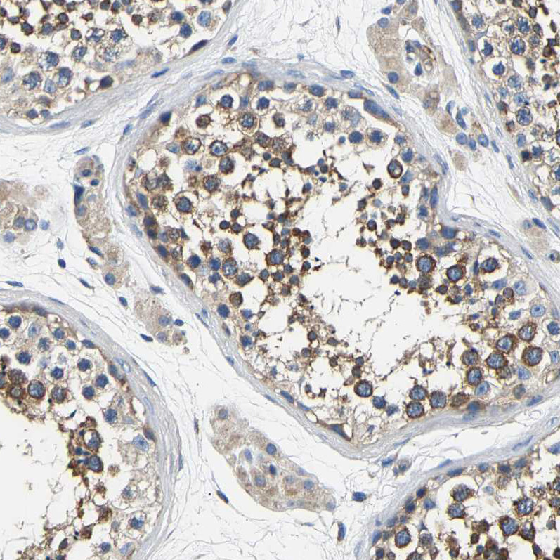 Immunohistochemical staining of human testis shows strong granular cytoplasmic positivity in cells in seminiferous ducts.
